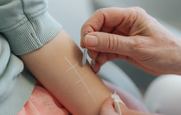 Allergologie Hautarzt Grünwald Dr. Silke Michelsen